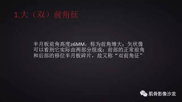 【PPT】膝关节解剖和半月板损伤影像解读