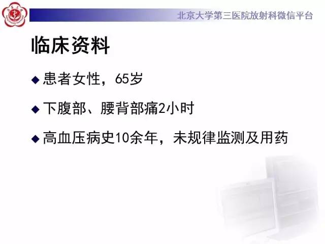 【病例】主动脉壁内血肿1例CT影像表现
