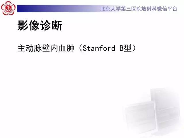 【病例】主动脉壁内血肿1例CT影像表现