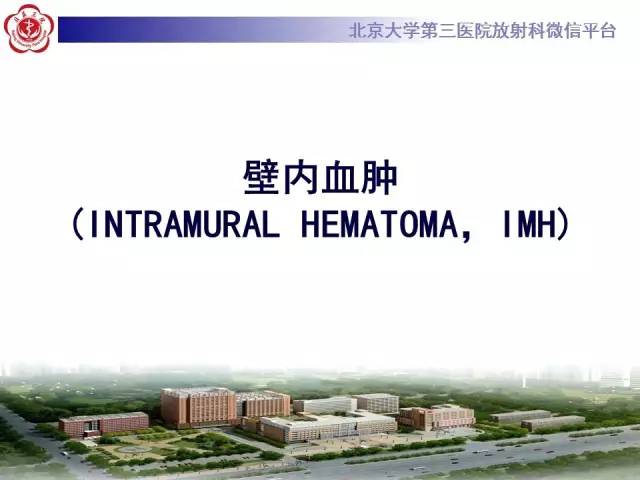 【病例】主动脉壁内血肿1例CT影像表现