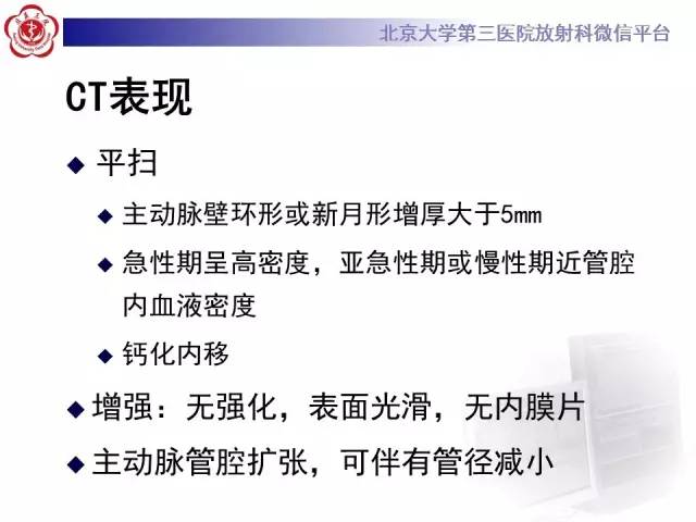 【病例】主动脉壁内血肿1例CT影像表现