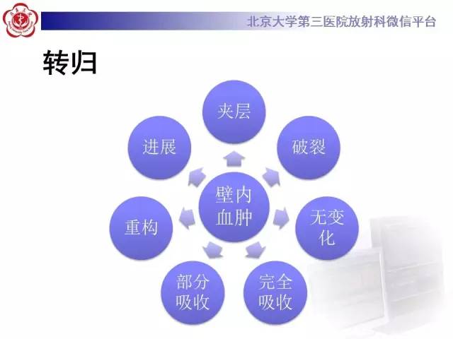 【病例】主动脉壁内血肿1例CT影像表现