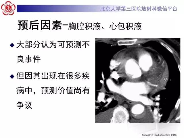 【病例】主动脉壁内血肿1例CT影像表现
