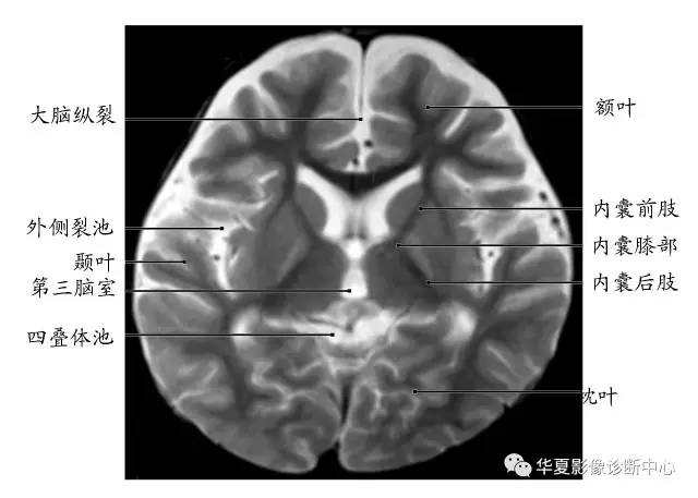 基底节和基底节区是一样的吗? 基底节和基底节区是一样的吗?