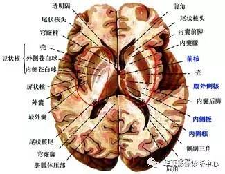基底节和基底节区是一样的吗? 基底节和基底节区是一样的吗?