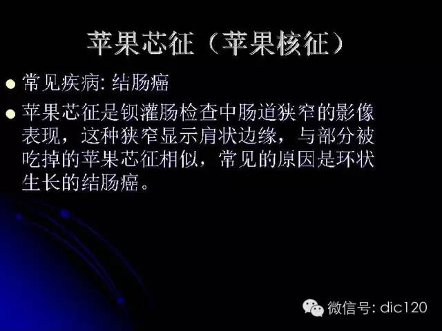 【PPT】一些经典影像征象图文解析