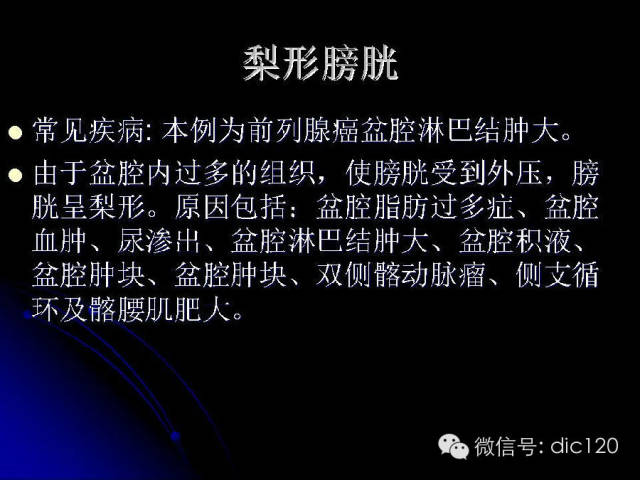 【PPT】一些经典影像征象图文解析