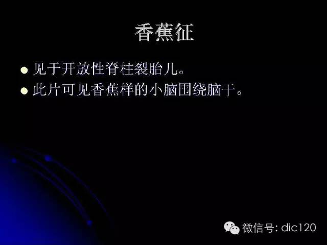 【PPT】一些经典影像征象图文解析
