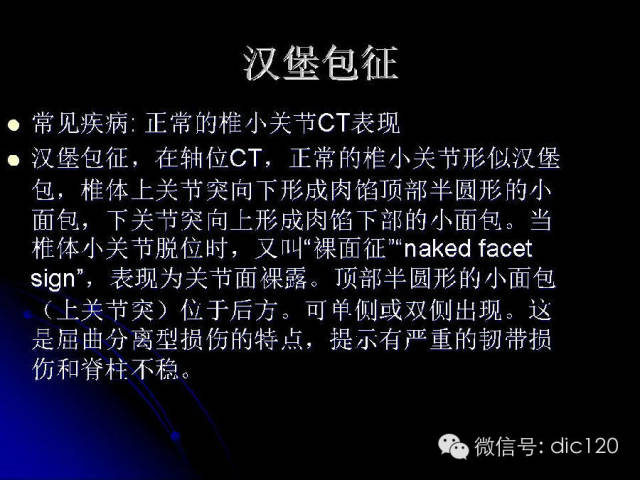 【PPT】一些经典影像征象图文解析