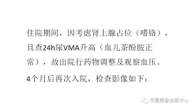 【病例】肾上腺畸胎瘤1例CT影像表现