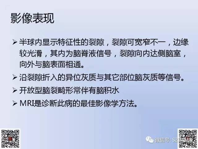 【PPT】脑裂畸形的MRI表现