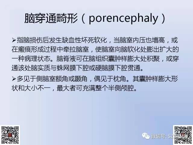 【PPT】脑裂畸形的MRI表现