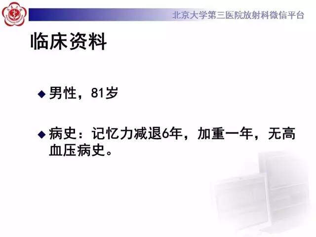 【病例】脑淀粉样血管病1例MR