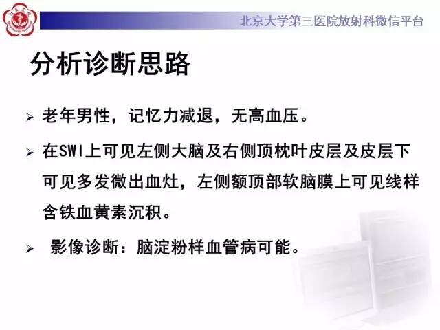 【病例】脑淀粉样血管病1例MR
