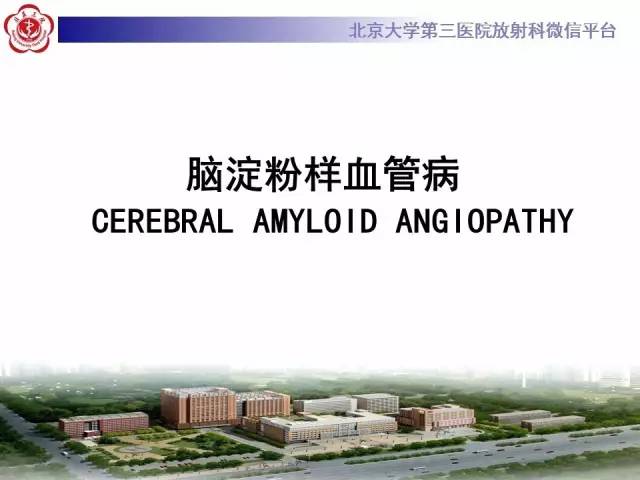 【病例】脑淀粉样血管病1例MR