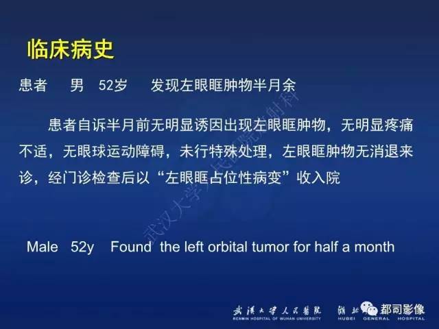 【PPT】眼眶淋巴增生性病变影像诊断
