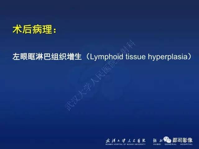 【PPT】眼眶淋巴增生性病变影像诊断