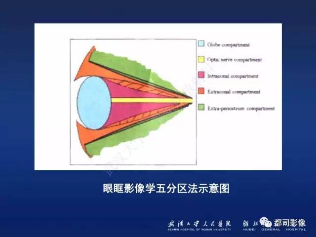 【PPT】眼眶淋巴增生性病变影像诊断
