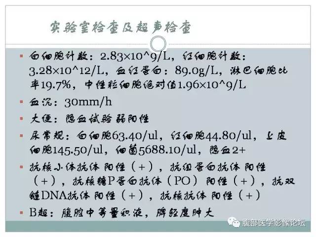 【病例】狼疮性肠系膜血管炎1例CT 【病例】狼疮性肠系膜血管炎1例CT