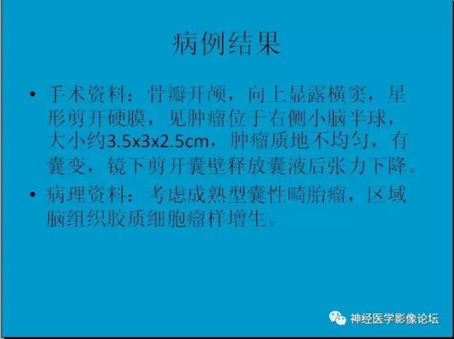 【病例】小脑半球囊性畸胎瘤1例MR
