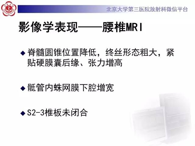 【病例】脊髓栓系综合征1例MR