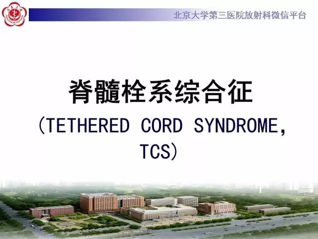 【病例】脊髓栓系综合征1例MR
