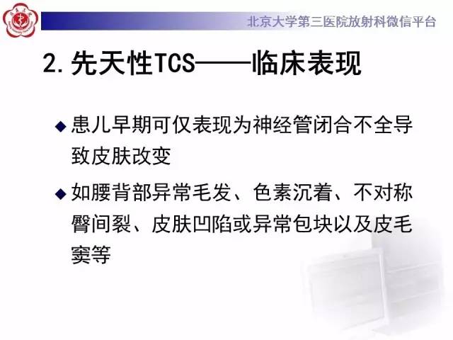 【病例】脊髓栓系综合征1例MR