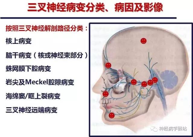 【PPT】三叉神经解剖、影像及临床