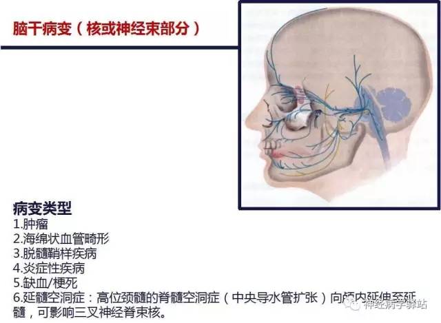 【PPT】三叉神经解剖、影像及临床