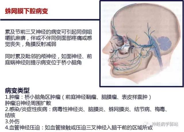 【PPT】三叉神经解剖、影像及临床