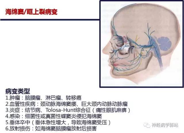 【PPT】三叉神经解剖、影像及临床
