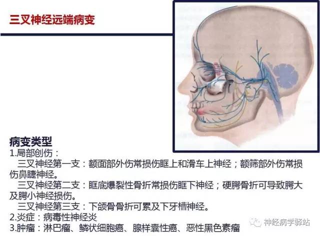 【PPT】三叉神经解剖、影像及临床