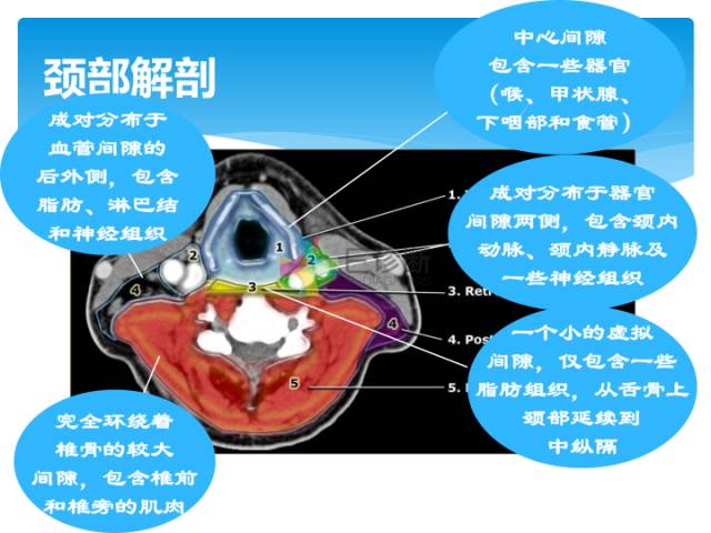 【病例】颈部间隙(舌骨下)解剖和病理