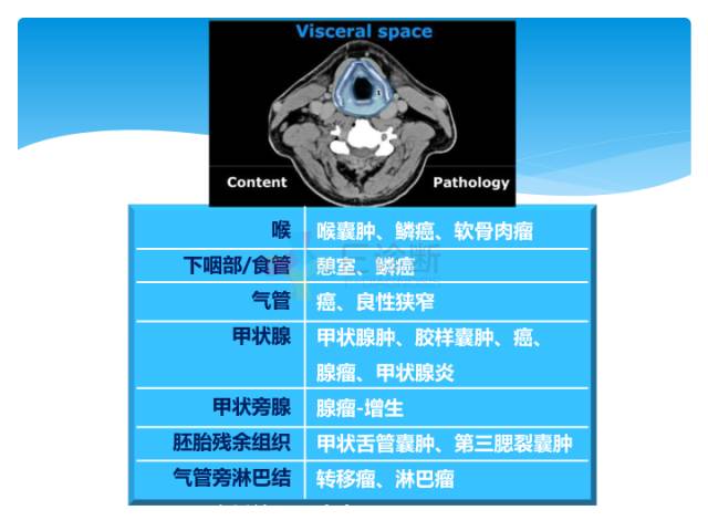 【病例】颈部间隙(舌骨下)解剖和病理