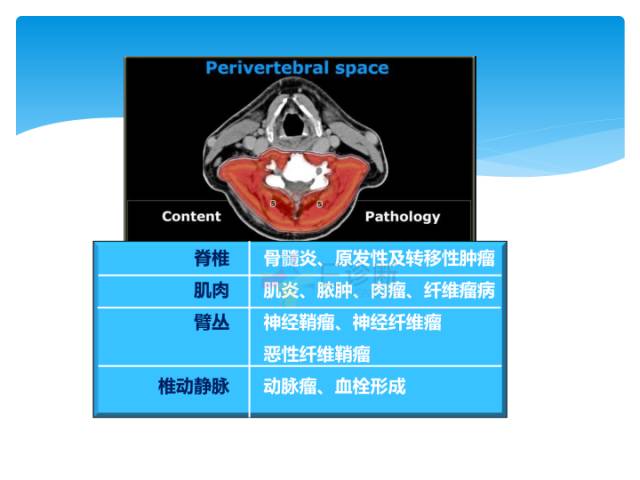 【病例】颈部间隙(舌骨下)解剖和病理