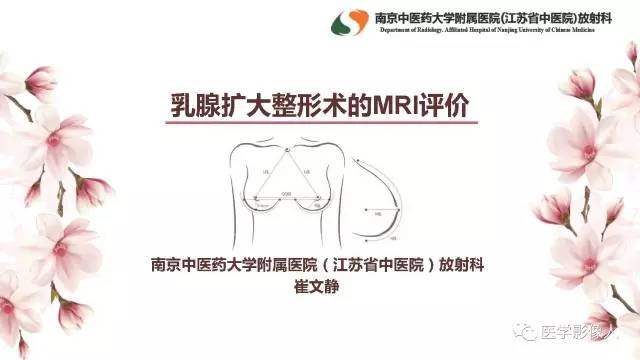 【PPT】乳腺扩大整形术的MRI评价