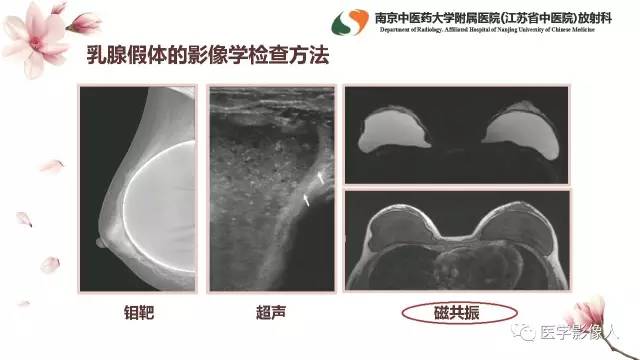 【PPT】乳腺扩大整形术的MRI评价
