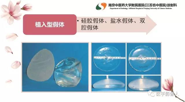 【PPT】乳腺扩大整形术的MRI评价