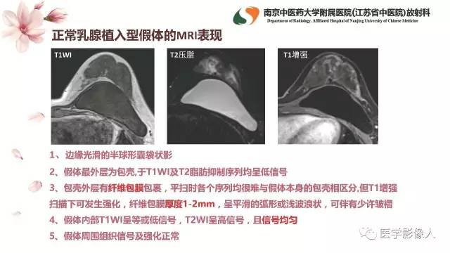 【PPT】乳腺扩大整形术的MRI评价