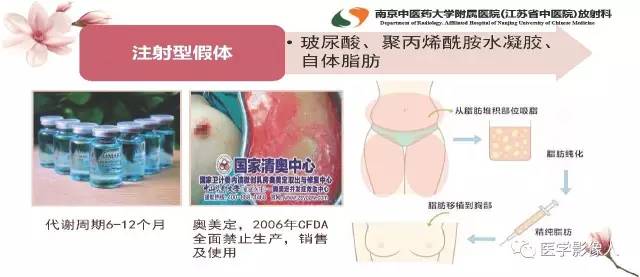 【PPT】乳腺扩大整形术的MRI评价