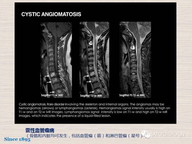 【PPT】骨髓病变的磁共振成像【ECR精选】