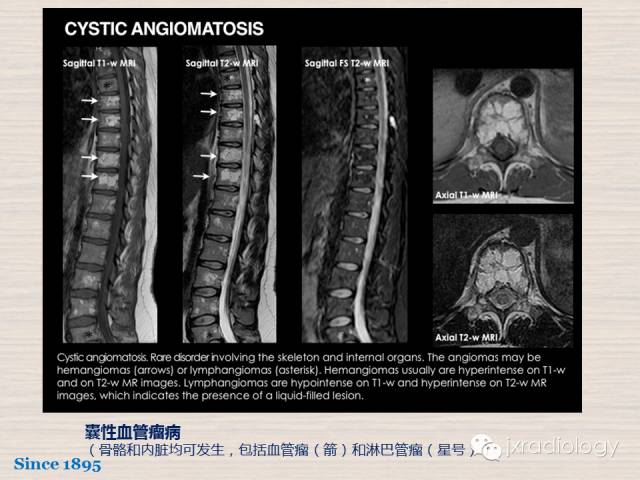 【PPT】骨髓病变的磁共振成像【ECR精选】