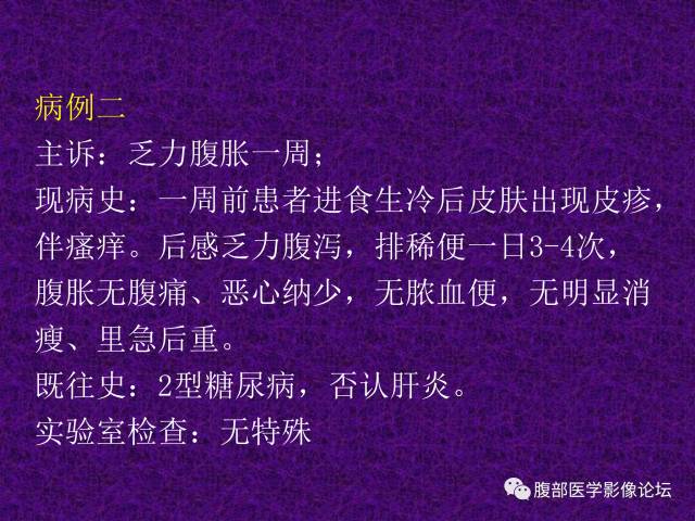 【病例】混合性肝细胞癌-胆管细胞癌1例CT