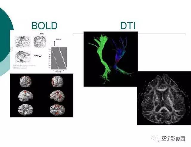 【PPT】脑血管病变影像诊断以及病例读片