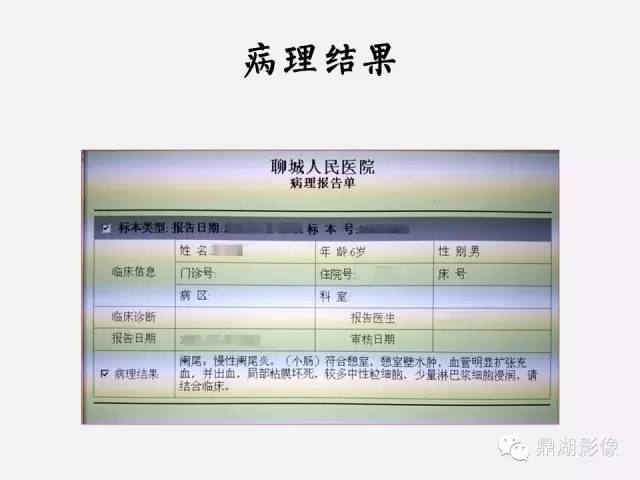 【病例】美克尔憩室(Meckels diverticulum) 一例影像诊断 【病例】美克尔憩室(Meckels diverticulum) 一例影像诊断