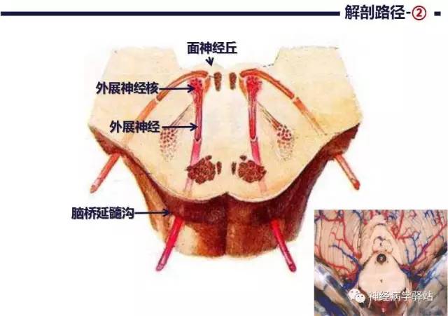 【PPT】展神经解剖、影像及临床