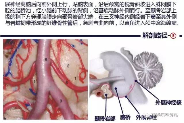 【PPT】展神经解剖、影像及临床