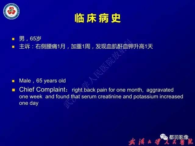 【PPT】IgG4相关疾病影像诊断