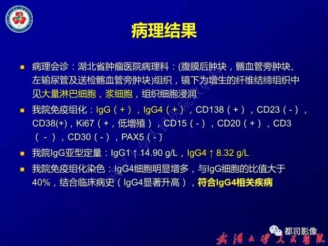 【PPT】IgG4相关疾病影像诊断