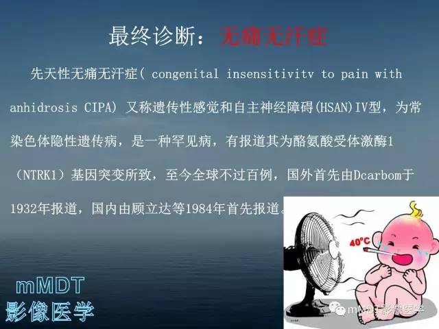 【PPT】无痛无汗症的影像诊断